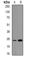 ULBP2 antibody