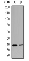 Anti-USF1 Antibody