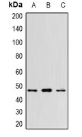 Anti-WNT5B Antibody