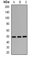 WT1 antibody