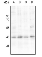 Anti-AT1 Antibody