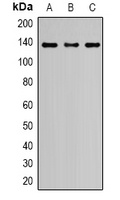 Anti-Nephrin Antibody
