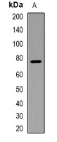 Anti-DDX3X (Phospho-T322) Antibody
