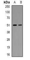 Anti-MNK1 (Phospho-T250) Antibody