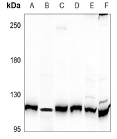Anti-AXL Antibody