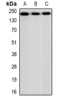Anti-CHD4 Antibody