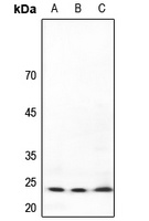 TP53INP2 antibody