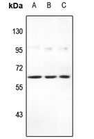 Anti-STEAP2 Antibody