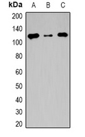 TSHZ2 antibody