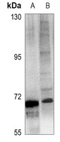 Anti-ICK Antibody