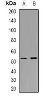 CHST9 antibody