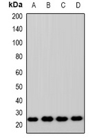 Anti-ZNRF2 Antibody