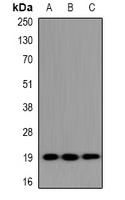 Anti-UBE2G1 Antibody