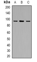 USP6NL antibody