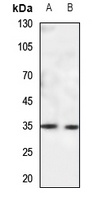 Anti-CACNG5 Antibody