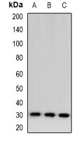 Anti-TSSK6 Antibody