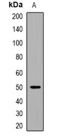 Anti-EEF1A (Acetyl-K146) Antibody