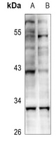 Anti-KLF13 (Acetyl-K166) Antibody