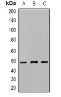 Anti-Beta-tubulin (Acetyl-K379) Antibody