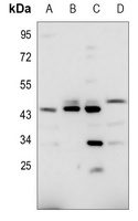 RHD antibody