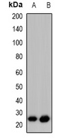 Anti-GAP43 (Phospho-S41) Antibody