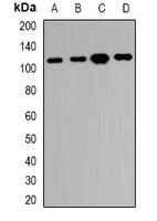 RBM26 antibody