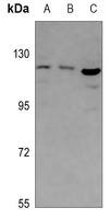 Anti-ABCF1 Antibody