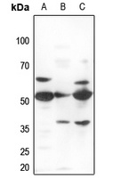 ZNF498 antibody