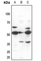 Anti-ZNF498 Antibody