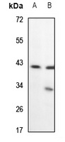 ACTC1 antibody