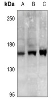 SYCP2 antibody