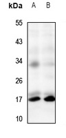 Anti-TRP14 Antibody