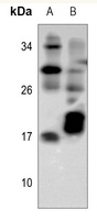 TCL1A antibody
