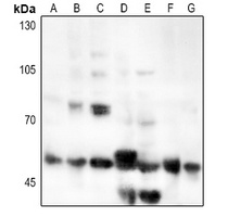 IL6R antibody