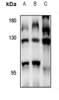 RFC1 antibody