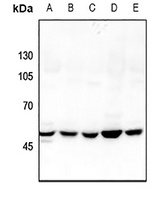 GDI2 antibody