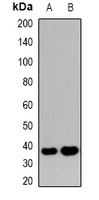 Anti-NHERF2 Antibody