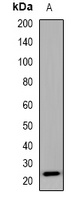 Anti-SEC22B Antibody