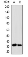 Anti-PP5 Antibody