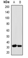 TFPI2 antibody