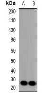 Anti-FGF11 Antibody