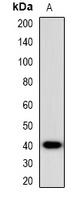 Anti-CCR5 Antibody