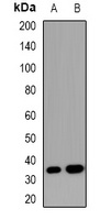 SOCS2 antibody