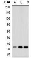 Anti-CDK6 Antibody