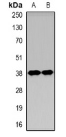 KIM1 antibody