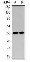 Anti-KIM1 Antibody
