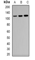 Anti-CD21 Antibody