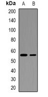 Anti-WISP3 Antibody