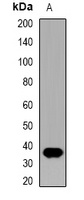 Anti-IL-12B Antibody