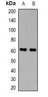 Anti-Perforin 1 Antibody